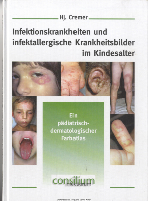 Infektionskrankheiten und infektallergische Krankheitsbilder im Kindesalter : ein pädiatrisch-dermatologischer Farbatlas