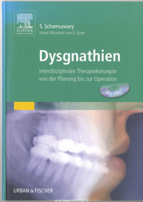 Dysgnathien : interdisziplinäre Therapiekonzepte von der Planung bis zur Operation